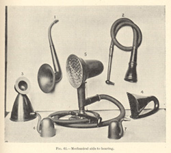 Mechanical hearing devices