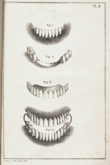 Plate illustrating false teeth from Harris' 'The Dental Art,' 1839