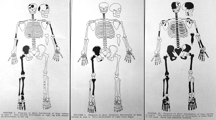 Leg Bones - Medical Art Library  Medical anatomy, Anatomy bones