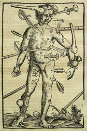 'Wound-man' from Paracelsus's 'Great surgery,' 1537