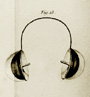 Itard illustration of earcup hearing device